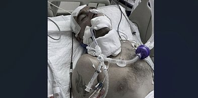 Gniezno. Rodzina obwinia szpital po zgonie 47-latka