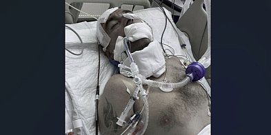 Gniezno Rodzina obwinia szpital po zgonie 47-latka