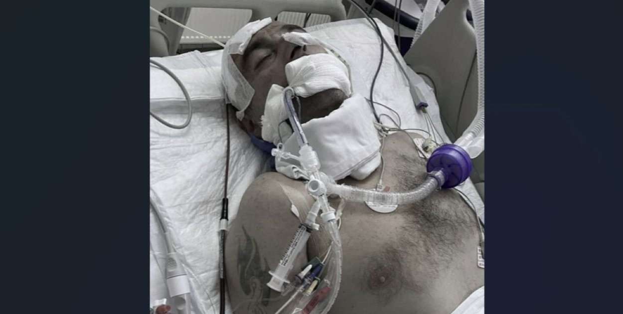 Gniezno. Rodzina obwinia szpital po zgonie 47-latka